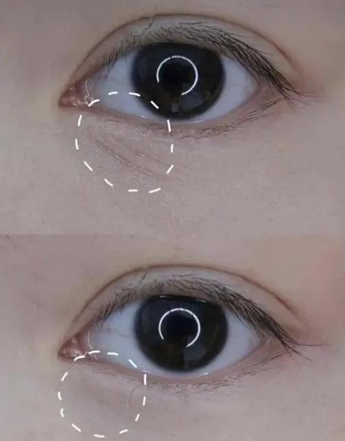 屈臣氏眼霜真的有效吗,屈臣氏好物推荐眼霜去细纹