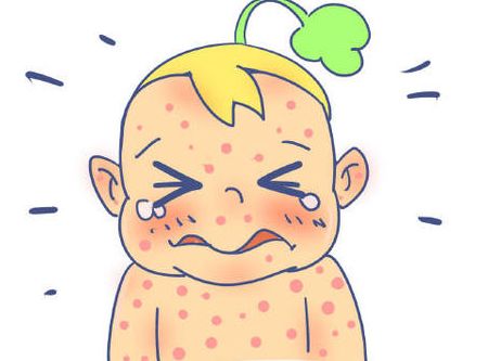 哺乳期忌口的食物哪些是回奶的,哺乳期湿疹忌口食物大全