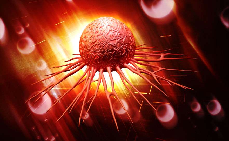 癌症复发后转移，还能救吗？医生直言：4个方法或能救上一命