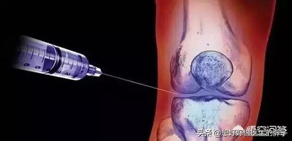 辟谣膝关节,年轻人膝盖有骨刺能根治吗