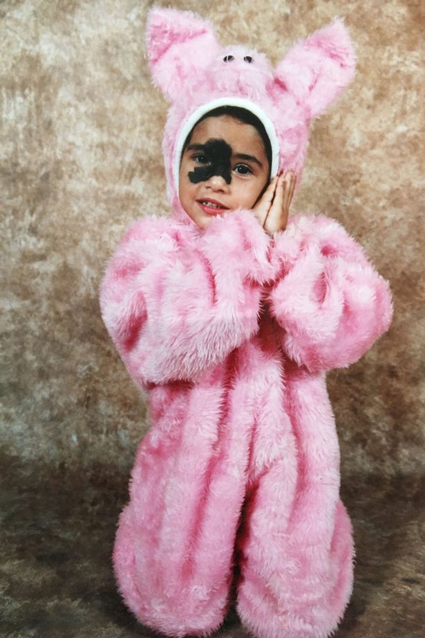 巴西女子鼻梁间有块大胎记，一点也不违和，还成为了知名模特