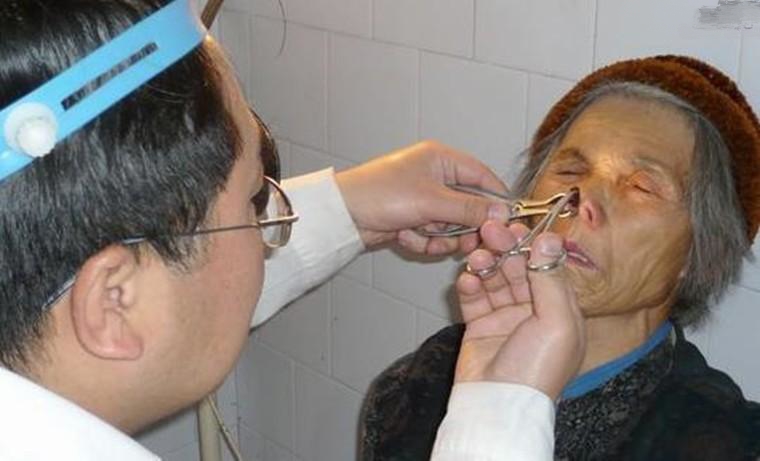 被蚂蟥钻身体里到底有多恐怖,蚂蝗能进入人的大脑里吗