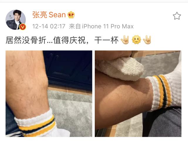 张亮凌晨脚受伤，却被网友骂“弃糟糠得报应”，他怒怼对方没脑子