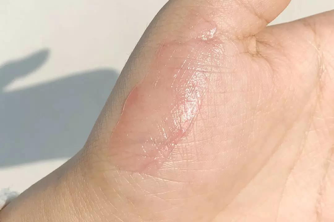 润唇膏真心好用推荐,跟风买的大牌唇釉405