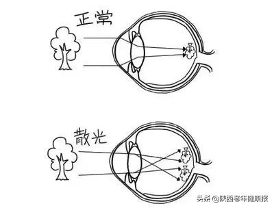 宝宝视力检查异常是什么意思,宝宝眼睛的异常现象