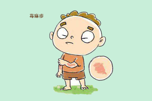 儿童得了荨麻疹皮肤会变紫色吗,孩子起荨麻疹痒是什么原因