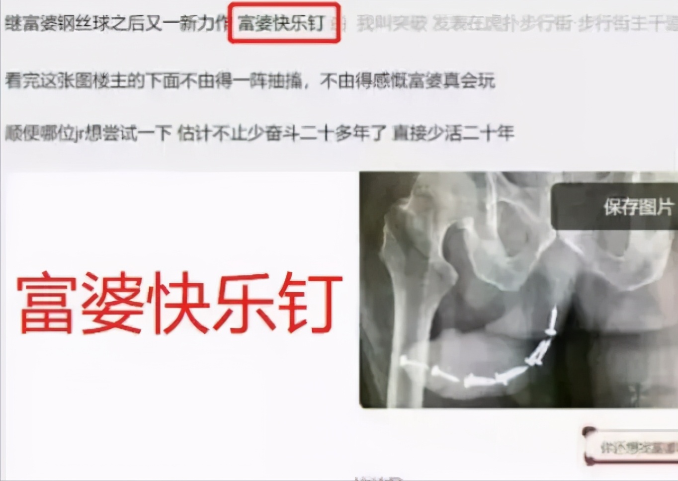 50cm“仙女管”插入少女胃里,这种自虐工具竟在淘宝卖疯了