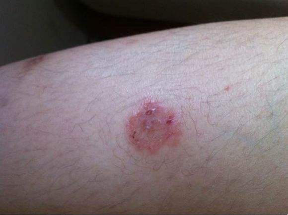 猫咪打喷嚏会传染别的猫吗,猫咪打喷嚏传染人吗