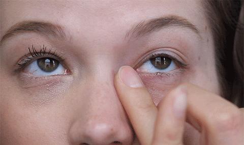 祛除眼袋的小妙招红霉素软膏,男生怎么祛除眼袋最快最有效