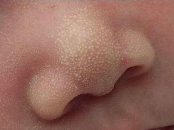 新生儿护理知识大全100题,育儿小知识新生儿护理常见知识