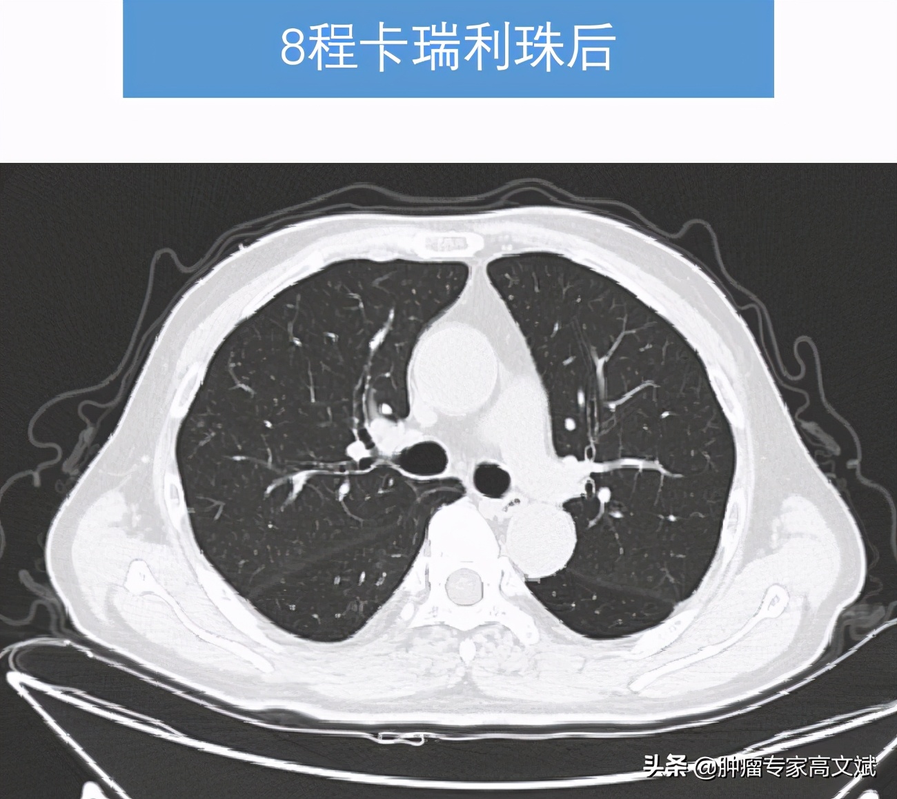 不怕打仗能打胜仗,连续作战能打胜仗