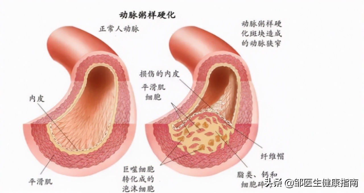 为什么说女人50是个坎,55岁下肢无力而且疼是怎么回事