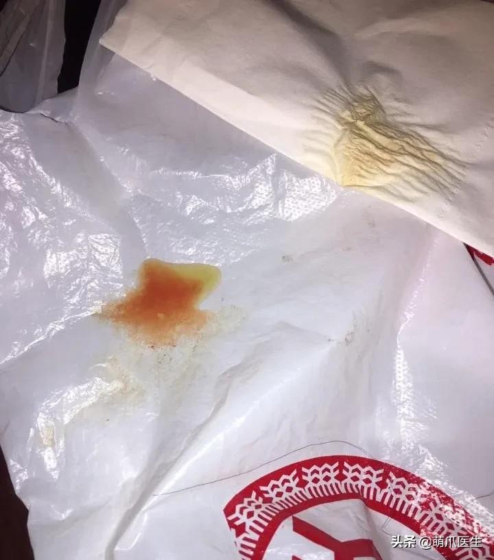 猫突然喜欢咬东西,怎么改掉猫吃猫砂的毛病