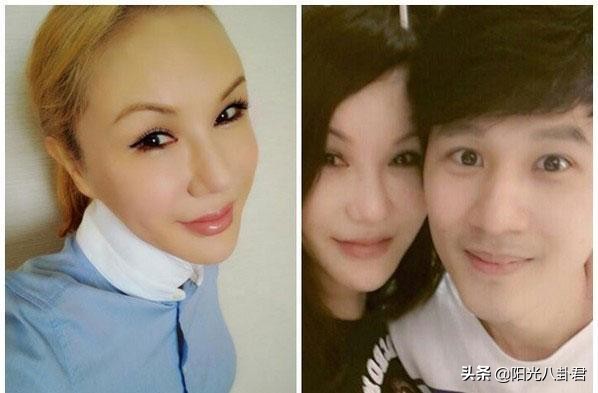 网红艾比做变性手术了吗,网红艾比做手术了吗