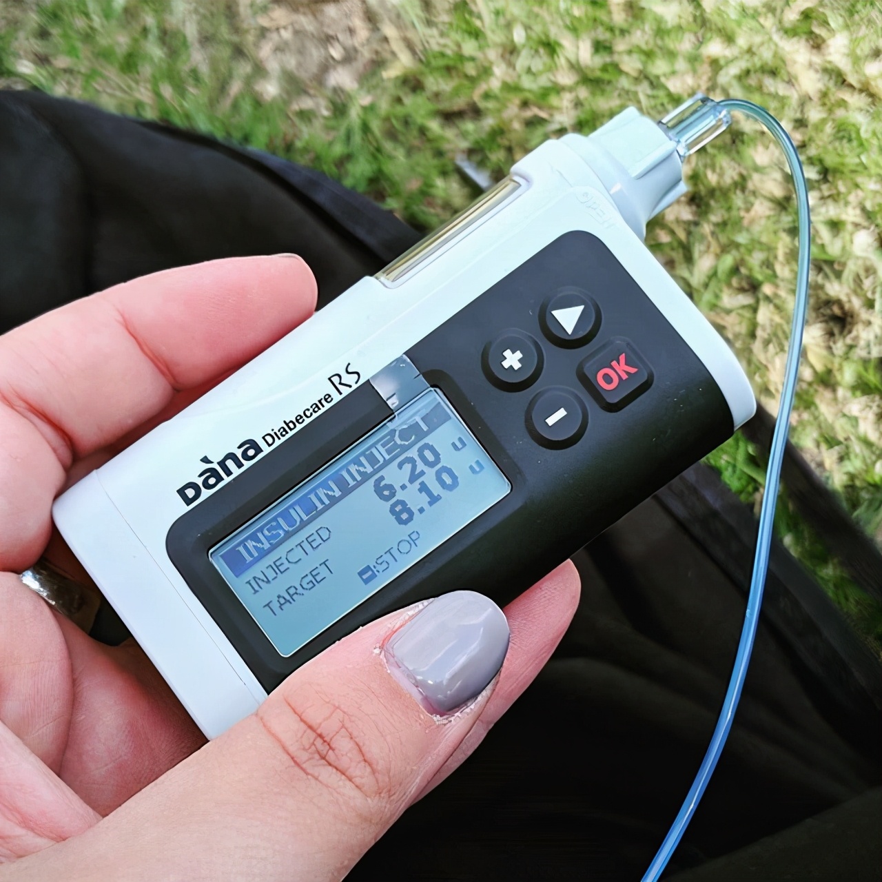 丹纳闭环胰岛素泵什么意思,丹纳胰岛素rs泵操作视频