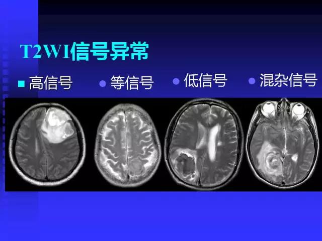 头颅mri读片视频教程,颅脑mri读片入门教程视频讲解全集