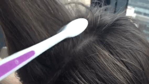 论秃头少女如何自救,秃头少女自救技巧