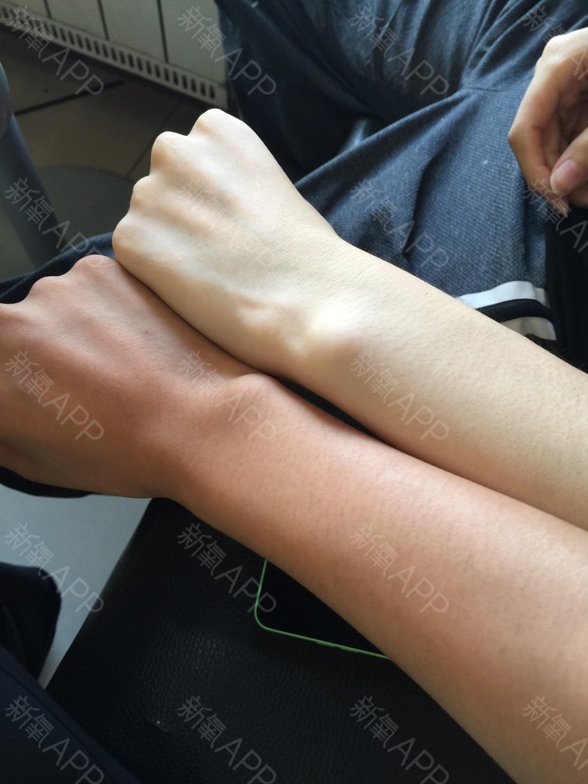 美白针真的可以彻底白吗,美白针有危害吗