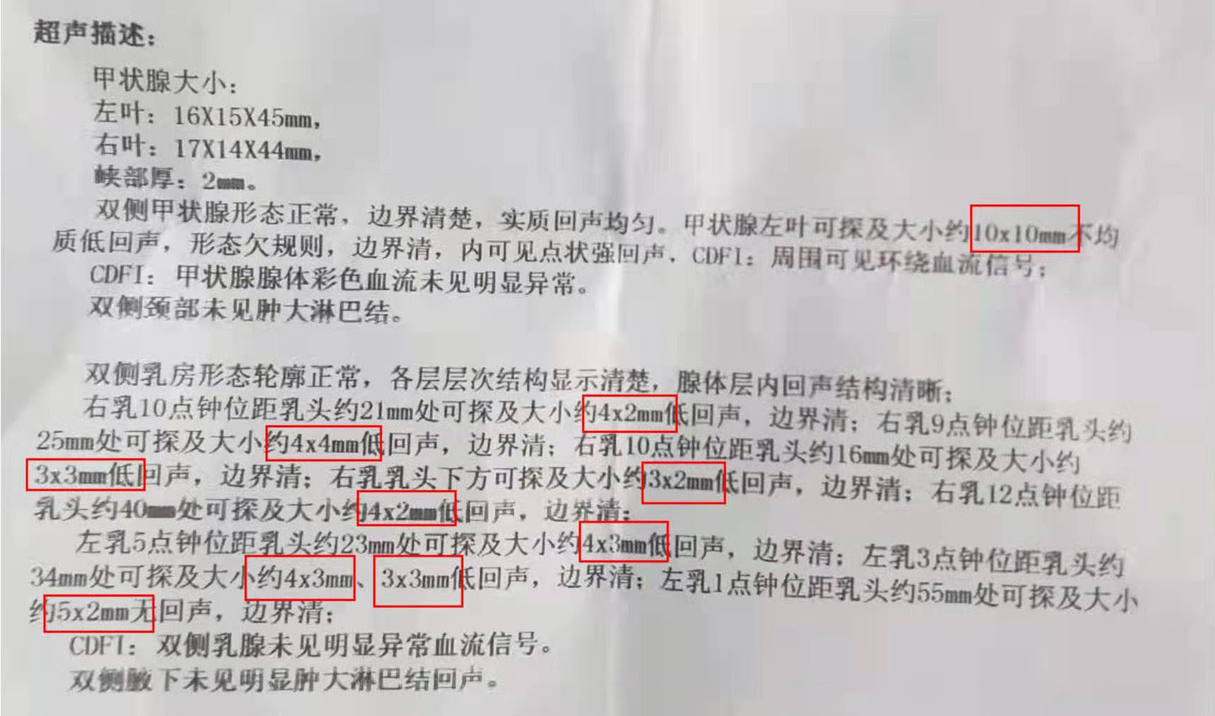 甲状腺结节有什么不同样的症状,甲状腺结节并腺瘤