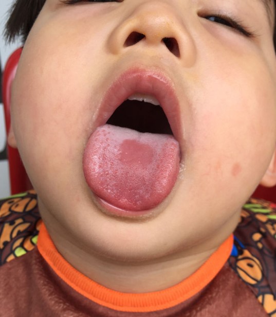 孩子总是发火易怒是什么原因,小孩经常发火对身体的危害