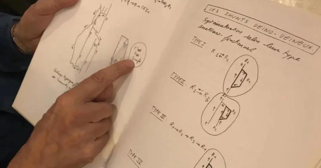 chiva治疗下肢静脉曲张价格,chiva治疗静脉曲张