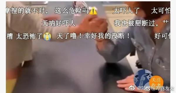 友情和骨头一起裂开！女生团建掰手腕骨折。怎样防止掰腕子骨折？