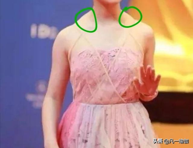 怎么改善溜肩让肩膀变平的视频,溜肩一招改善