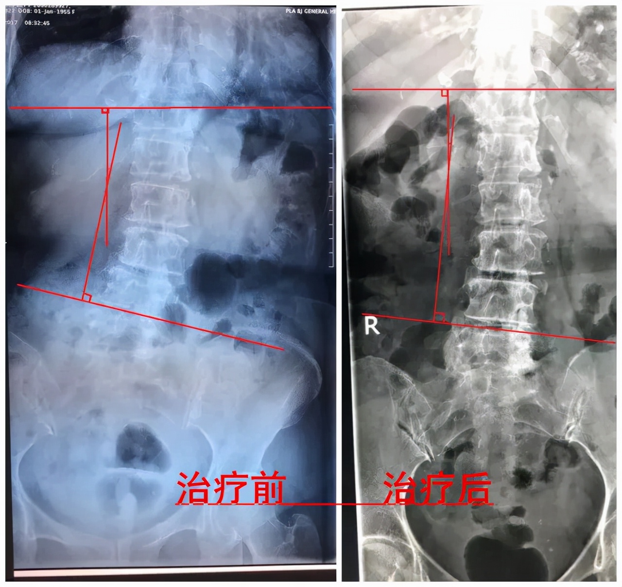 “私人订制”的康复治疗，尽在雅达国际康复医院