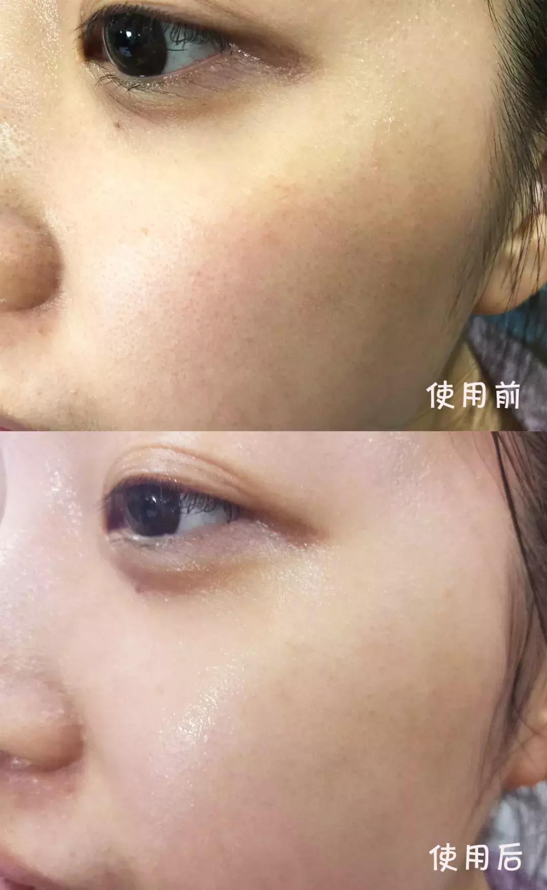 年轻人的抗老精华,用了惊艳的抗老精华