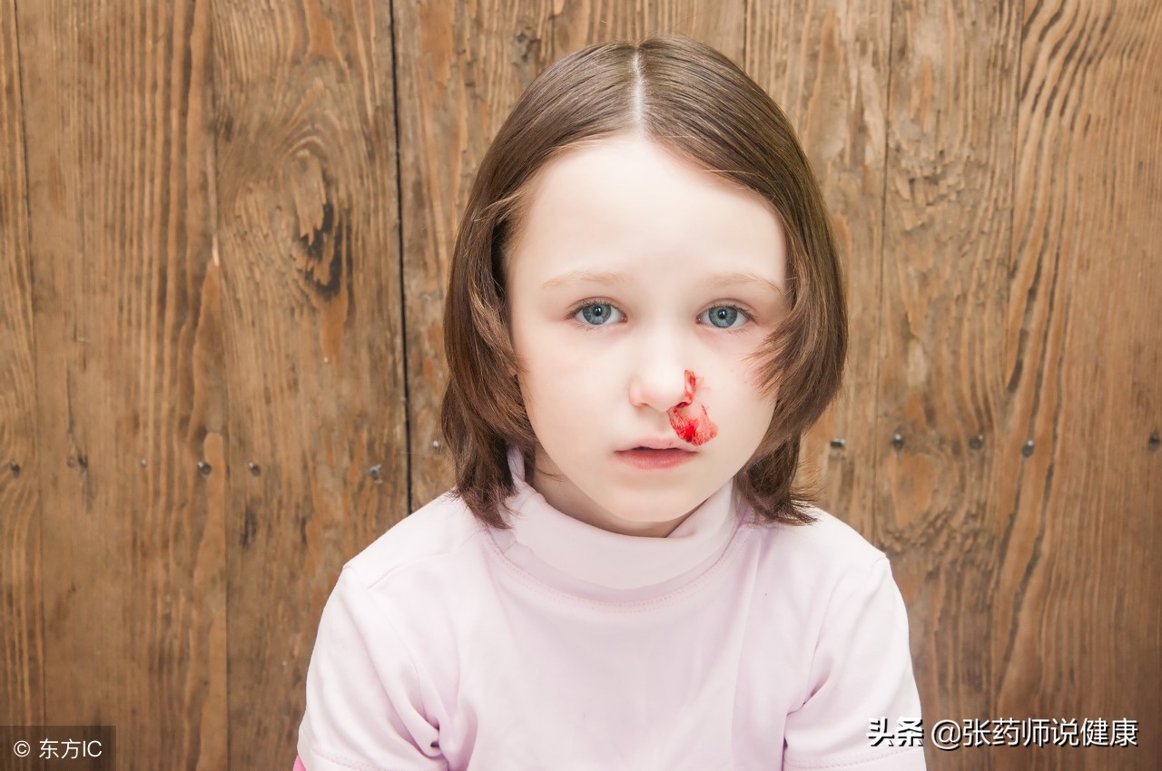 小孩有鼻炎一到冬天就流鼻血,小朋友过敏性鼻炎最近经常流鼻血