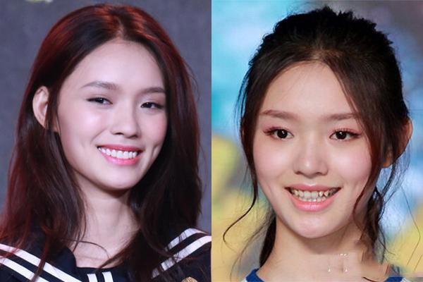 吴宣仪做牙齿前后对比,吴宣仪做整牙