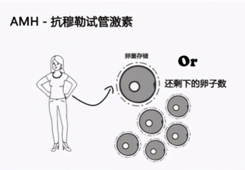 抗缪勒氏管激素amh是什么,抗缪勒氏管激素amh是查什么