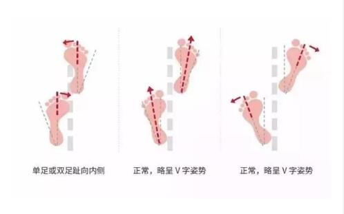 运动鞋怎么选才不会入坑,运动鞋怎么选择更好