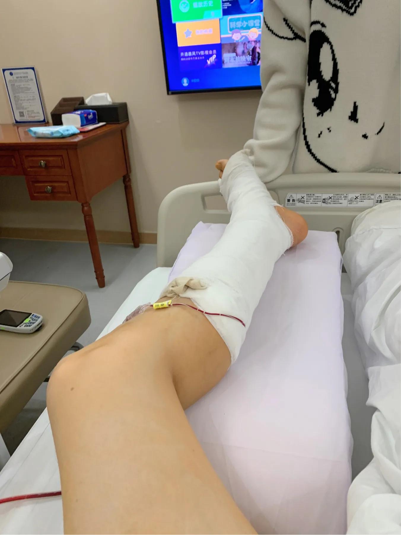 一张图看懂跟腱断裂,跟腱断裂日常