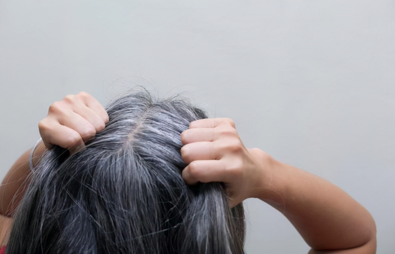 两鬓和后脑勺白发是什么原因,白发长在不同部位代表什么