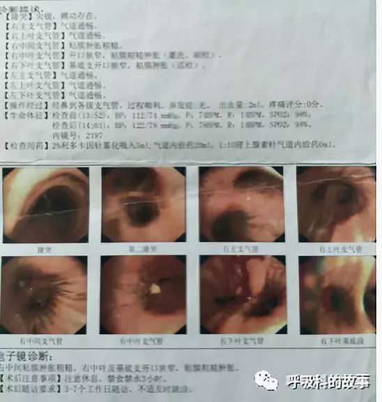 怎么应用统计学做调查,统计学方法可以解决的主要问题