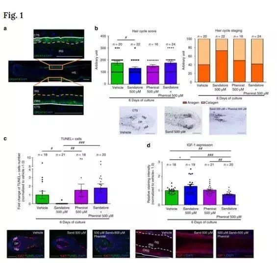 90后没有发际线,90后00后如何不脱发