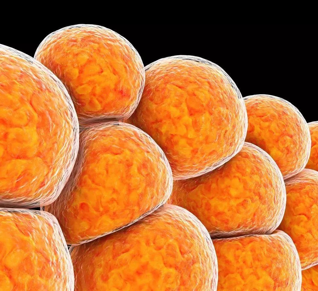 割掉眼袋什么样子,把眼袋割掉泪沟会自己消失吗