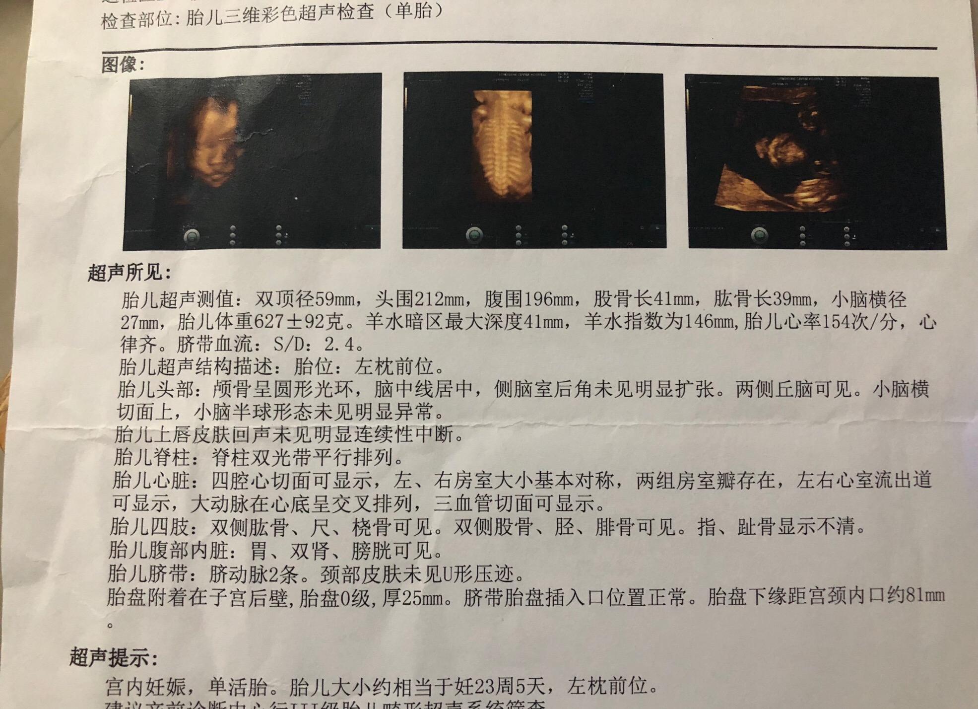 妇产科医生对孕妇的忠告,妇产科孕早期健康指导