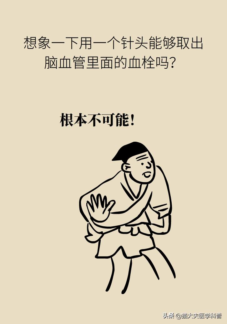 不手术能彻底治好血栓外痔吗,介入治血栓最好的方法