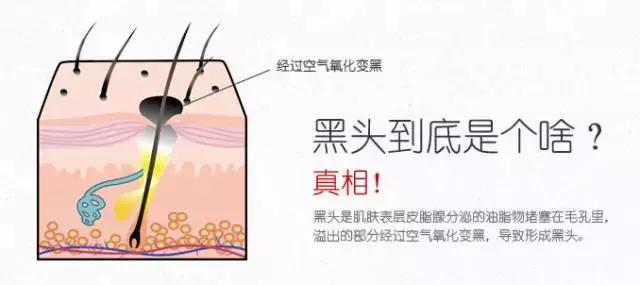 不花钱草莓鼻去除小妙招,不挤鼻子怎么去黑头