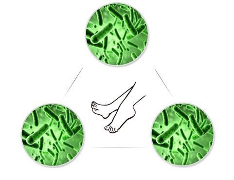 足癣奇痒难耐怎么办,奇痒难耐的癣怎么治疗能彻底根除