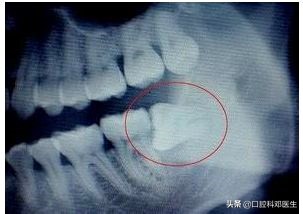 别让一张嘴毁了整张脸,别让一颗牙齿毁了一张脸