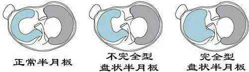 结束体育生涯,结束运动员生涯