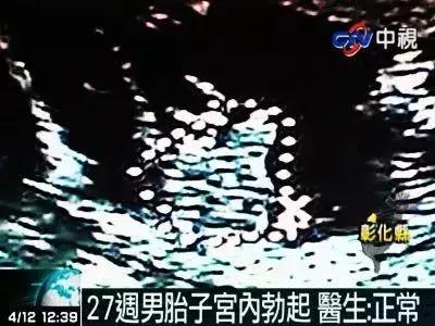 无知！坑娃！一个完全错误的“疾病”！居然还有专门的“诊室”！