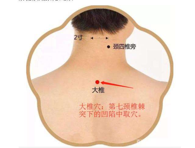 大椎穴的取穴方法与作用,中医操作大椎穴视频教程