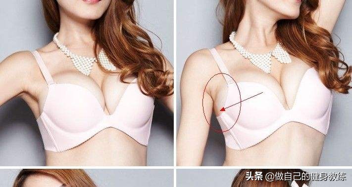 副乳不用做手术也可以消除吗,副乳怎么消除最快最有效手术