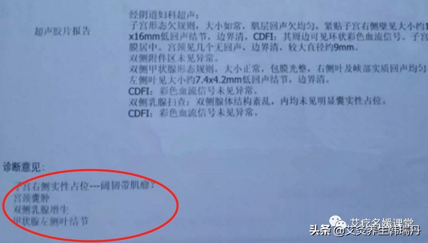 子宫肌瘤结节能治愈吗,肌瘤结节症状