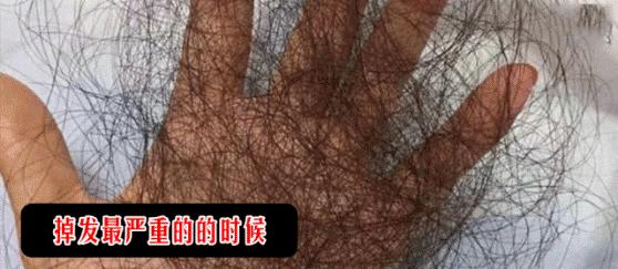 油头救星澳洲茶树洗发水,茶树精油酸性顺滑洗发水