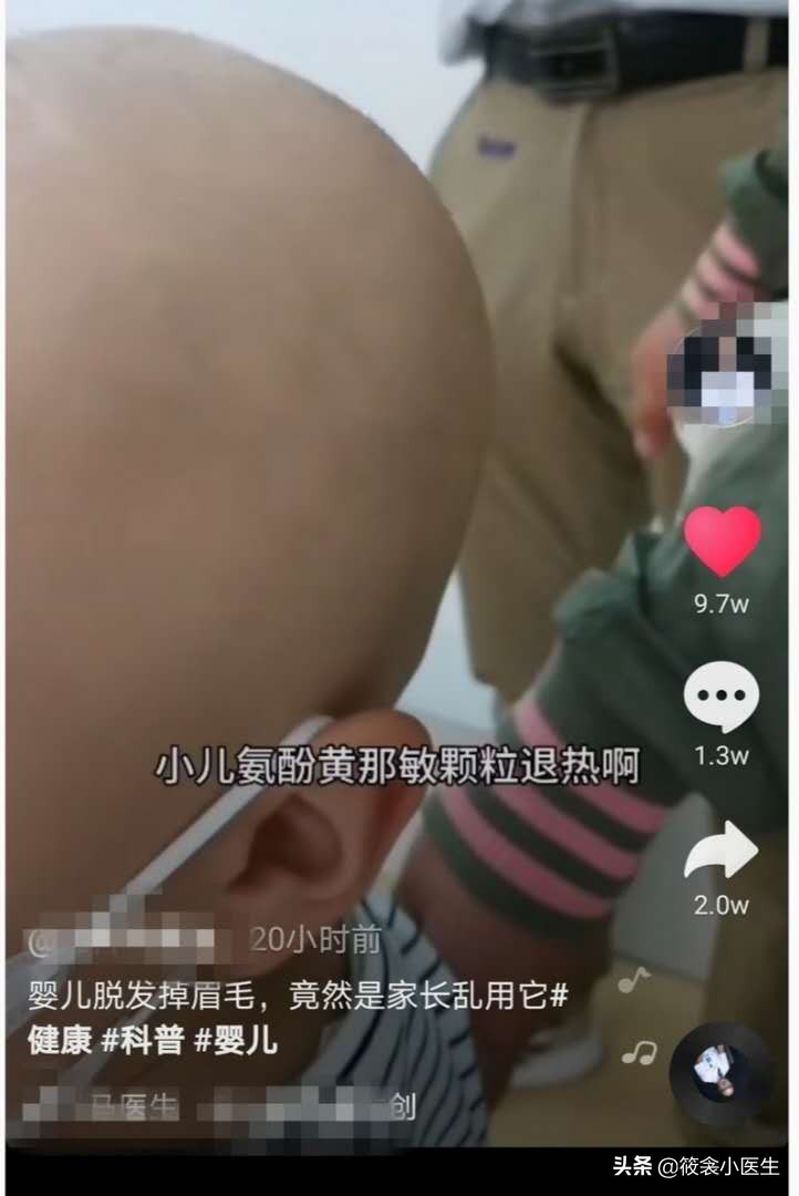 婴儿脱发,孩子喝氨酚黄那敏掉发